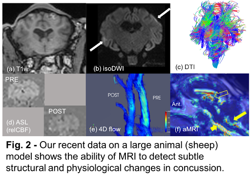 MRI images of a sheep's brain.