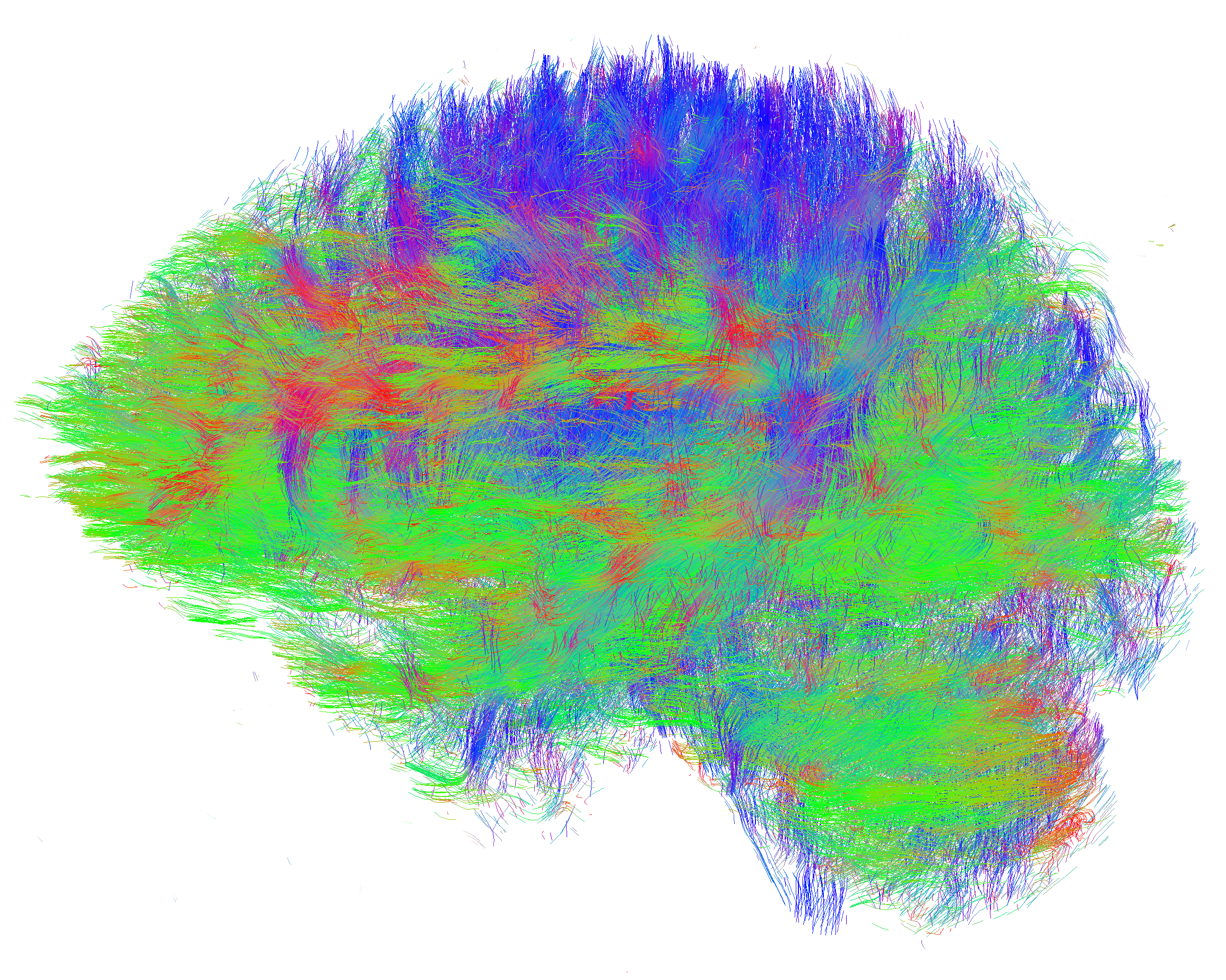 A map of axon pathways in the brain A visualisation of all axon pathways in the brain.