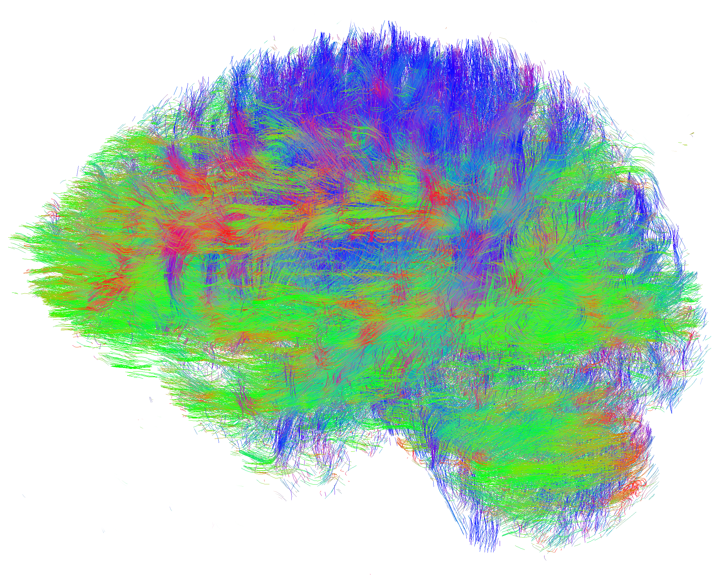 A visualisation of all axon pathways in the brain.