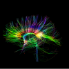 Image similar to an x-ray showing the synapse networks of the brain.