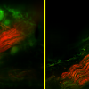 Photos of nerves and neural cells on the heart atrial surface before (left) and after (right) deconvolution.
