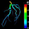 Computer model image of blood vessels